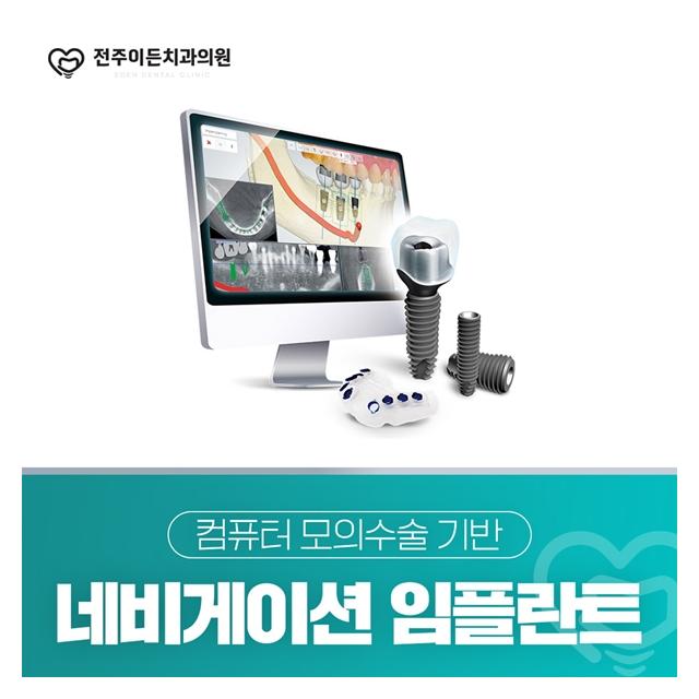 네비게이션 임플란트 컴퓨터 모의수술 기반 더욱 정교하고 섬세한 진료