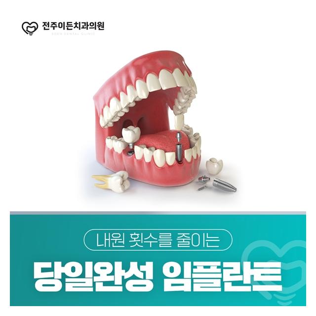 당일완성 임플란트 내원 횟수를 줄여 편하게 치료합니다